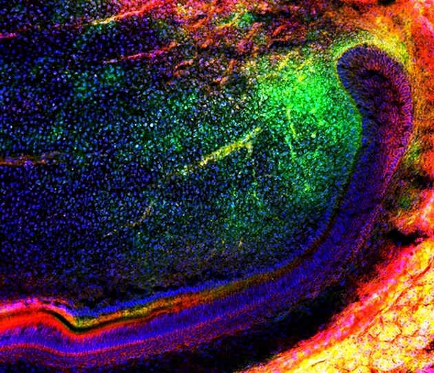 Zahnreparatur der Zukunft: Stammzellen zur Dentinbildung in Mäusezähnen entdeckt