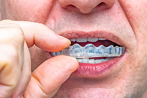 Wrigley Prophylaxe Preis 2021: Projekt zur frühen Diagnose von Zähneknirschen