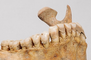 Mumienforschung: Alter Zahnstein – neue Einblicke in die Evolution der Mundflora