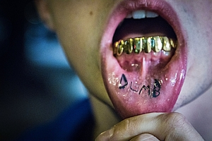Was ist nur los mit der „Zahngemeinbildung"