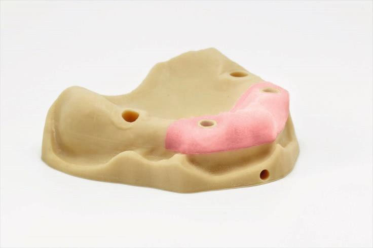 Kulzer erweitert sein 3D-Drucksystem mit neuen Materialien